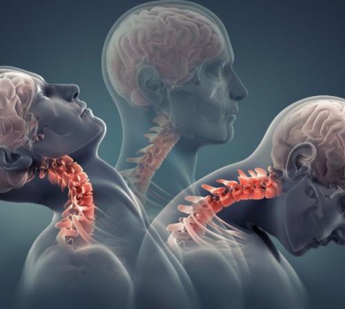颈椎骨质增生不及时治疗有哪些危害